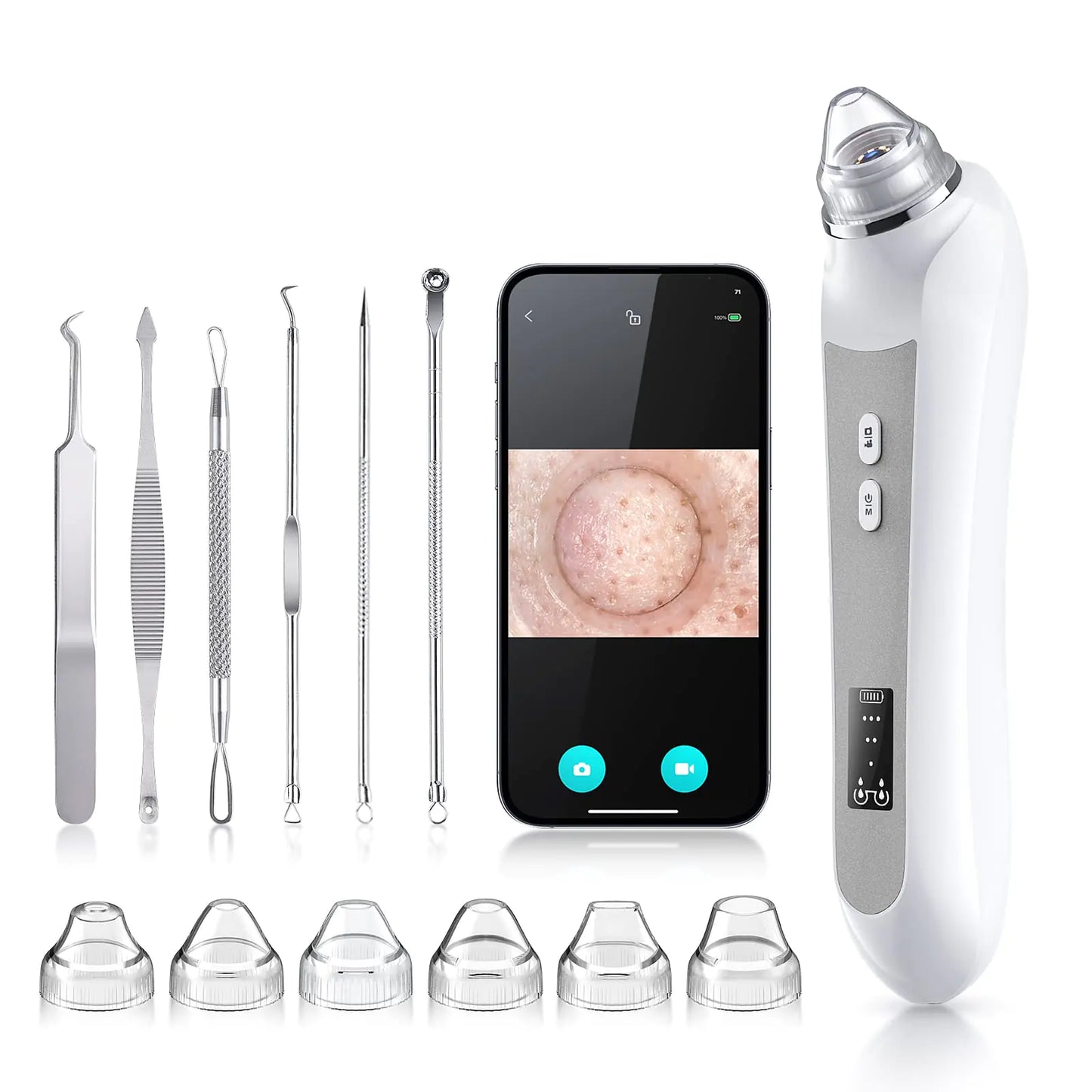 Blackhead Remover Vacuum with Camera